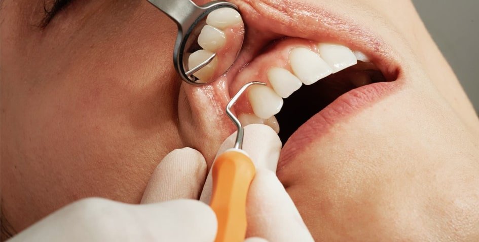 Traitements des racines dentaires Rhône Dental Clinic