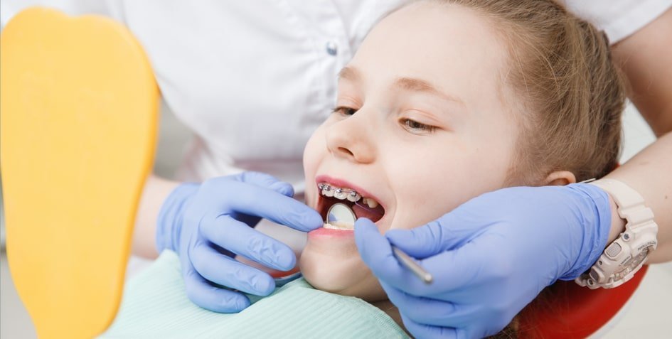 Rhone Dental Clinic Article Orthodontic Treatment For Children Image01