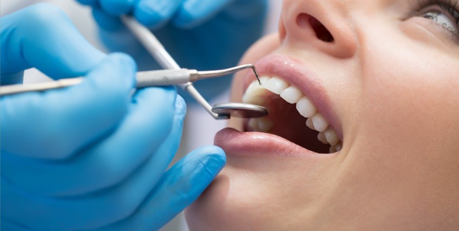Rhone Dental Clinic Article Scaling Geneva Image01