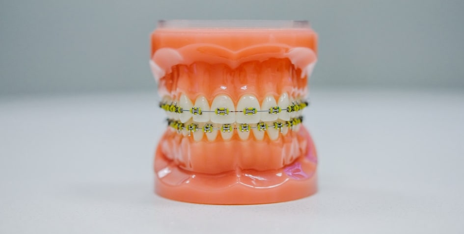Rhone Dental Clinic Article Greffe Gencive Image01
