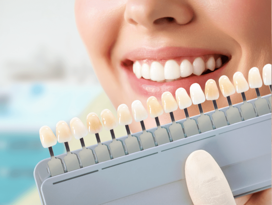 Rhone Dental Clinic Blanchiment Dentaire Legislation Et Idees Recues