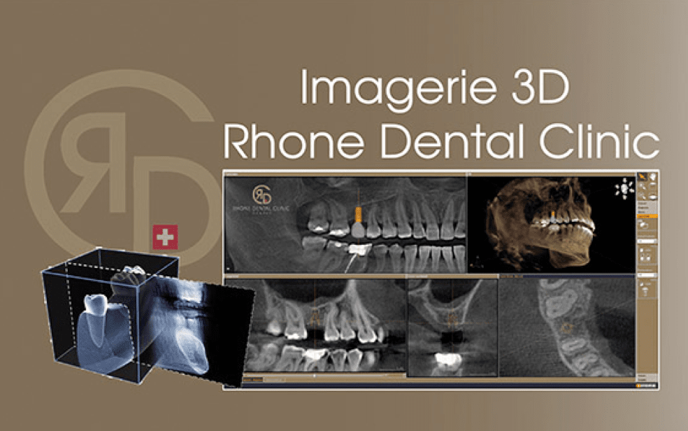 Rhone Dental Clinic Imagerie Scanner 01