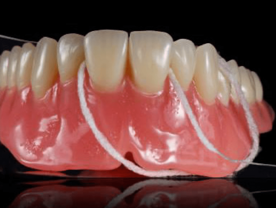 Rhone Dental Clinic Dental Crowns Prothese Removable