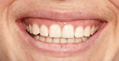 Rhone Dental Clinic Gingival Smile 02 Front