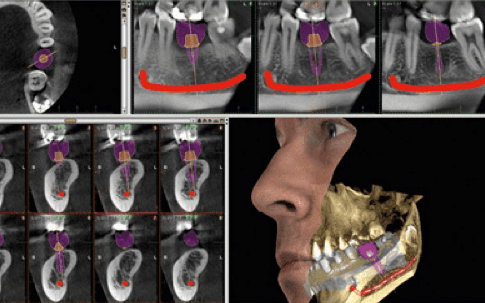 Rhone Dental Clinic Imaging Scanner 02