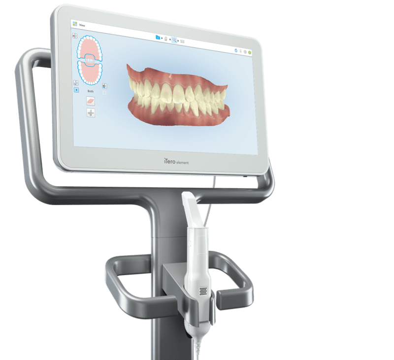 Rhone Dental Clinic Invisalign Clincheck