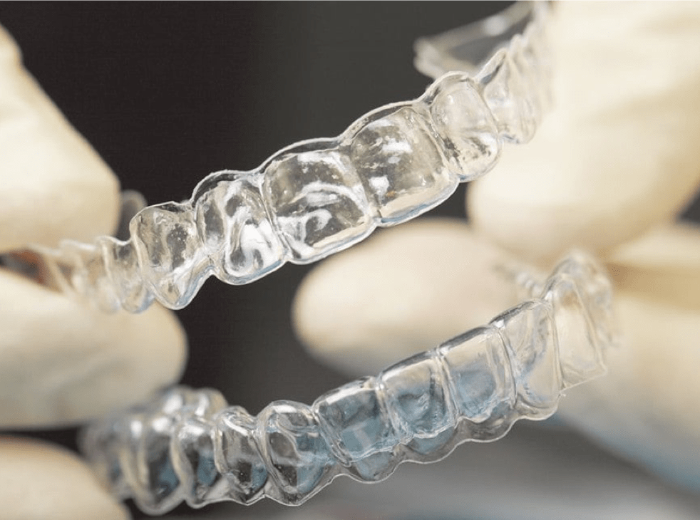 Rhone Dental Clinic Orthodontist Benefits Invisalign