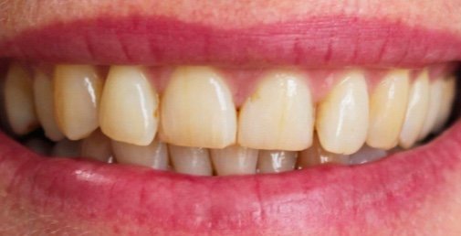 Rhone Dental Clinical Dental Before