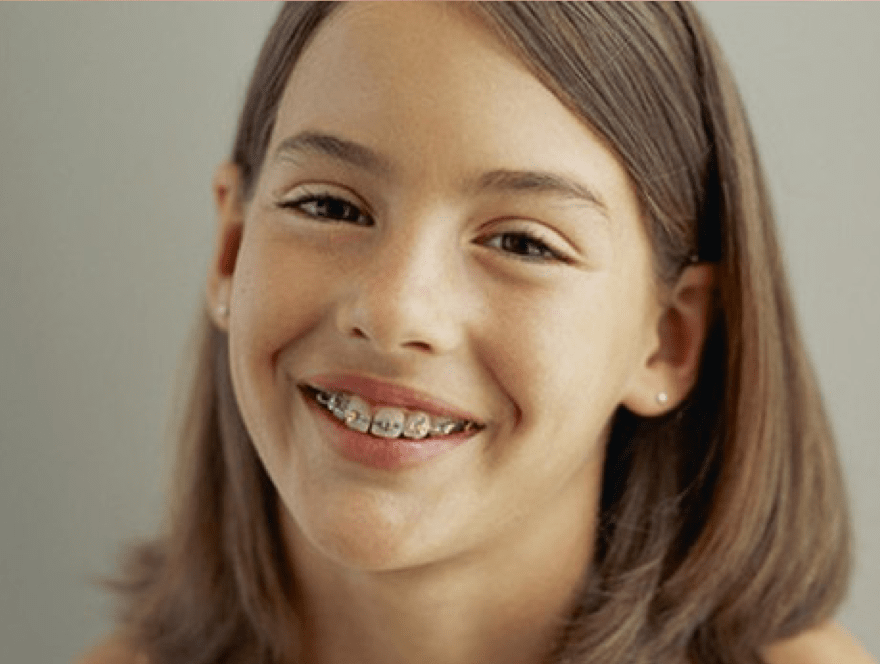Rhone Dental Clinic Orthodontist Diagnosis By Orthodontist Qualified